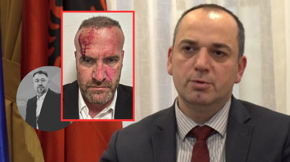 “Akt qyqar, kur s’kanë argumente, përdorin grushtet” – Haskuka reagon ashpër pas sulmit ndaj Mehanit
